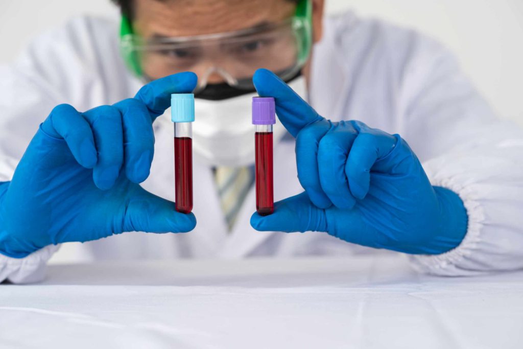 Benefits of private blood tests for health